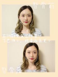 -FACE·日本小颜矫正美容整骨サロン