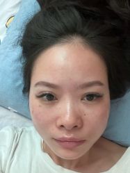 点击看大图 -广州健丽·去眼袋医疗美容机构