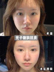 -成都大华医学美容医院