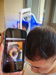 -碧莲盛·不剃发植发