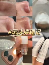 -skin79皮肤管理中心