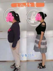 -Lily纤美·科技减脂中心