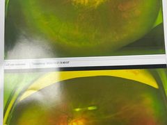 -武汉大学附属爱尔眼科医院(湖北总院)