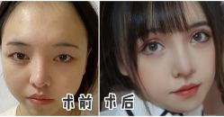 -深圳阳光医疗美容医院·旗舰店
