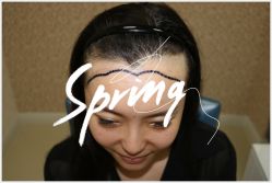 -大麦微针植发全国连锁