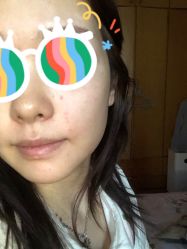 体验前-美瑞莎创美医疗美容