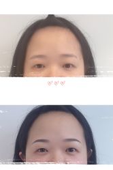 -MIVI半永久纹眉绣眉