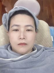 体验后-北京英煌医疗美容