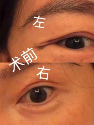 -天津伊美尔医疗整形美容专科医院