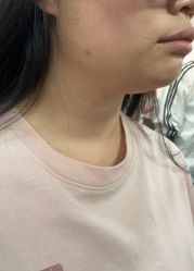 体验后-上海伊莱美医疗美容医院