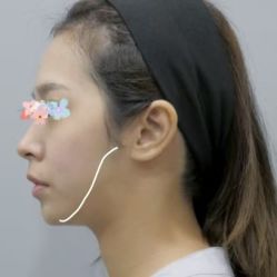 -素美医疗美容·西南眼鼻整形·修复基地