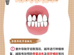 -上海仁爱医院口腔科 · 种植