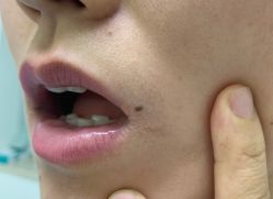 体验前-CMS西美斯·美式医疗美容