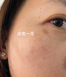 -小忠丽格医美