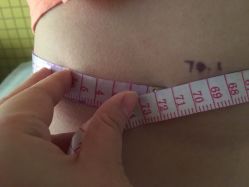 -肥三针腧穴瘦身馆