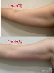 点击看大图 -栖SPA·ONDA ·美芙炫·海菲秀科技美肤中心