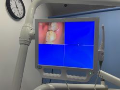 体验后-南京医科大学友谊整形外科医院