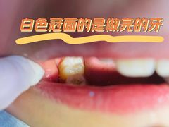 -极光口腔·矫正种植修复(锦江店)