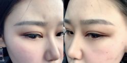 -长沙雅美医疗美容医院