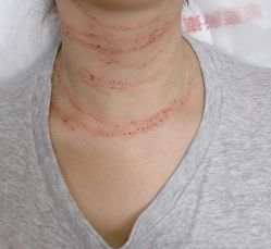 -深圳春天阳光医院·轮廓抗衰中心