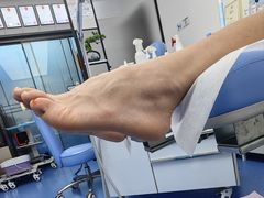 -Andrew指甲专科灰指甲·甲沟炎矫正·3D步态矫形鞋垫定制(上海法华镇路旗舰店)