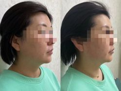 -赢韵美甲美睫瑞士净斑中心