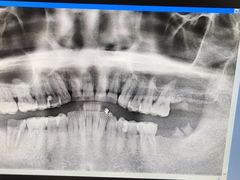 -上海市杨浦区牙病防治所