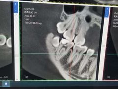 -Dr.Z dental仁康种植矫正中心