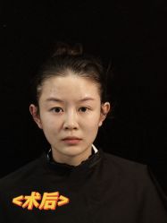 -云南吴氏嘉美医疗美容医院