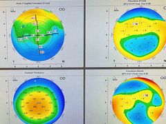 -昆明爱尔眼科医院