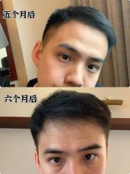 -雍禾植发全国连锁