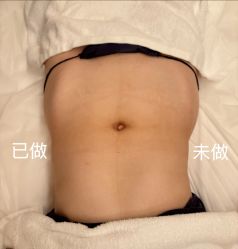 -Fundi张玉珊修身堂·indiba·BTL科技瘦身