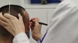 -大麦微针植发全国连锁