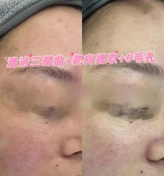 -Cream88颜皮肤管理中心