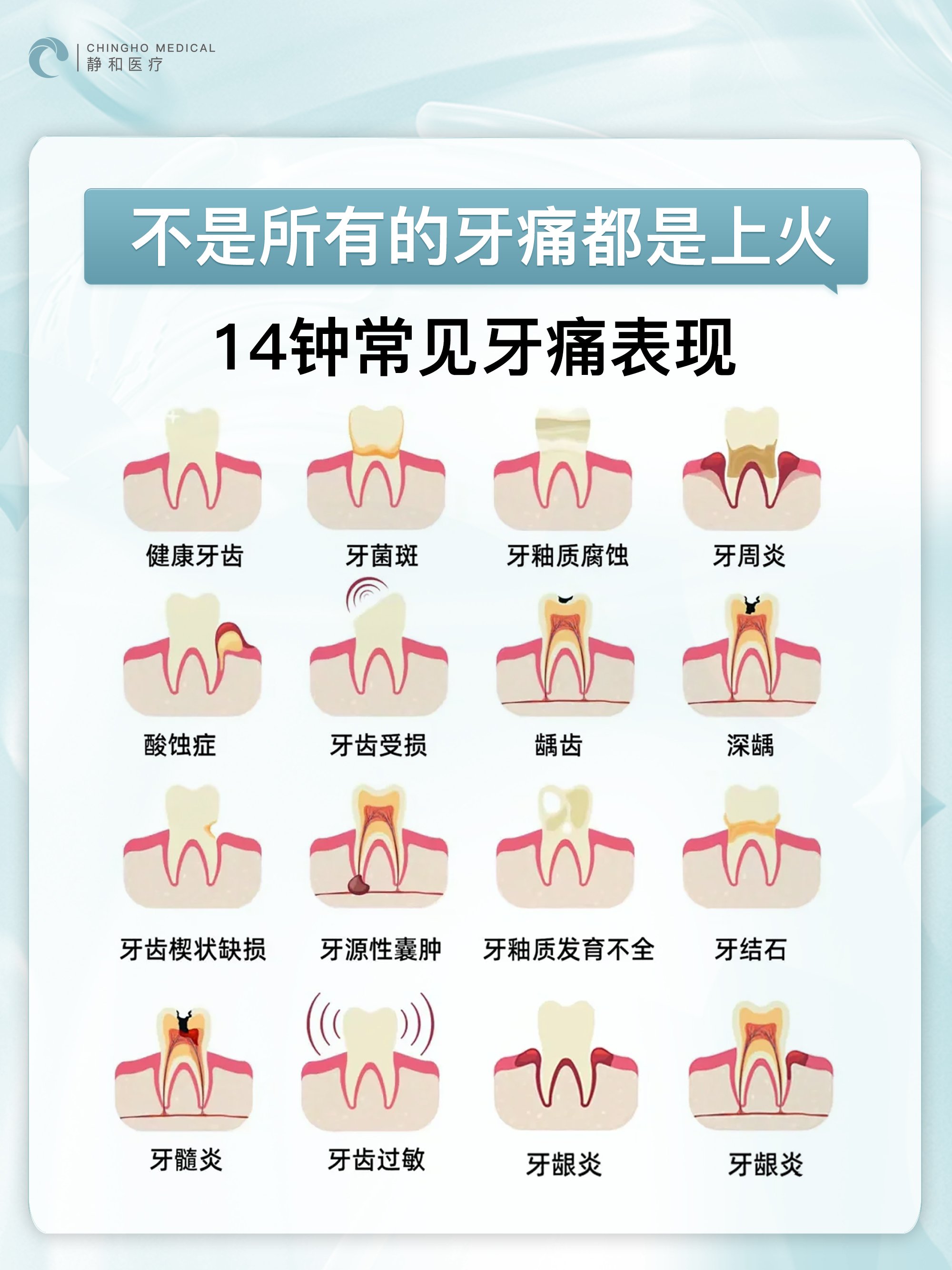 种牙疼吗需要多长时间图片