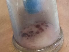 -牛市口盲人按摩(舒康分院)