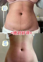-Fundi张玉珊修身堂·indiba·BTL科技瘦身