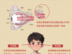 -星视野儿童近视弱视视力训练中心(富荟店)