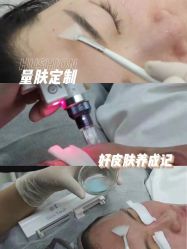 -LUNA皮相美·骨相美高级美感