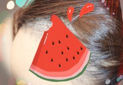 -大麦微针植发全国连锁