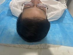 -熙朵美学植发·连锁品牌