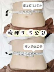 -Lily纤美·科技减脂中心