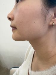 -长沙雅美医疗美容医院