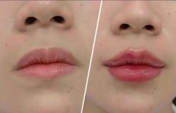 -云南吴氏嘉美医疗美容医院