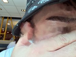 点击看大图 -熙朵美学植发·连锁品牌