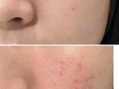 -上置·美兰优湖