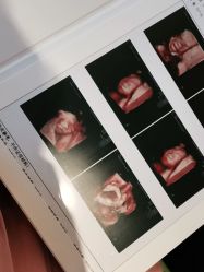 -杭州贝瑞斯美华妇儿医院·早孕·产检·儿科