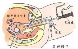 -重庆安琪儿妇产医院-妇幼保健联盟医院