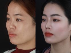 -北京米扬丽格医疗美容·联合丽格鼻整形中心