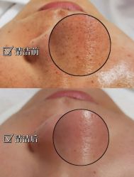 -露德瑪麗科技美肤·美迪迈·华熙生物
